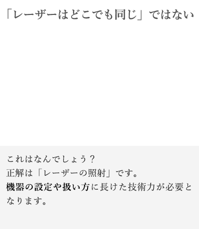 「レーザーはどこでも同じ」ではない