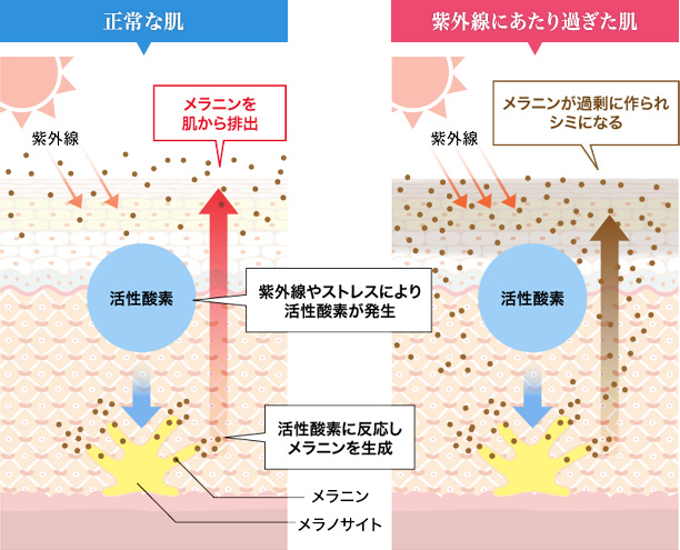 シミが出来るメカニズム